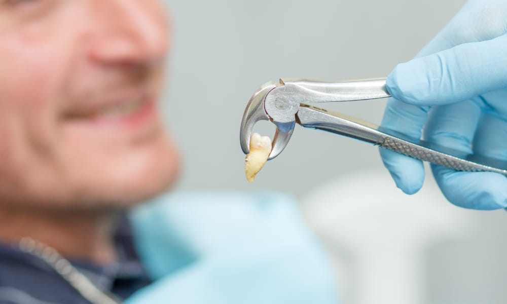 Wisdom Tooth Extraction Recovery