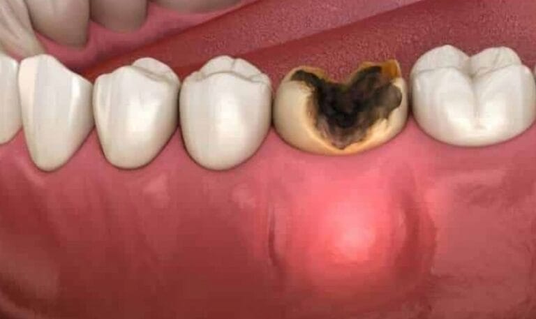is a black tooth an emergency