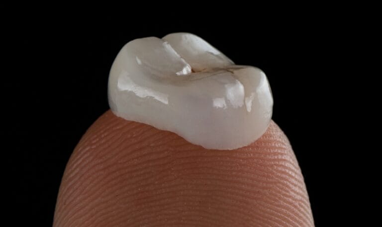 what to do when your dental crowns break