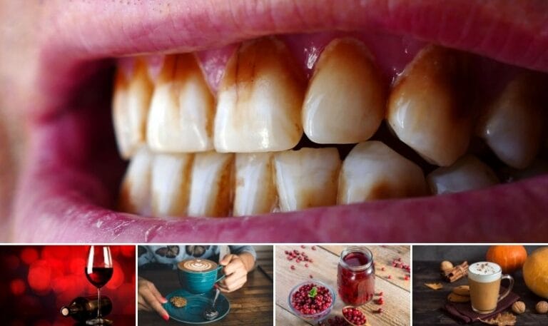 how thanksgiving beverages can stain your teeth