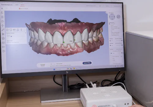Glidewell Milling unit available at Avery Dental Wellness in Dublin, OH