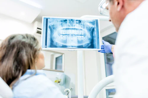 Digital Dental X-Ray in Dublin, OH, at Avery Dental Wellness